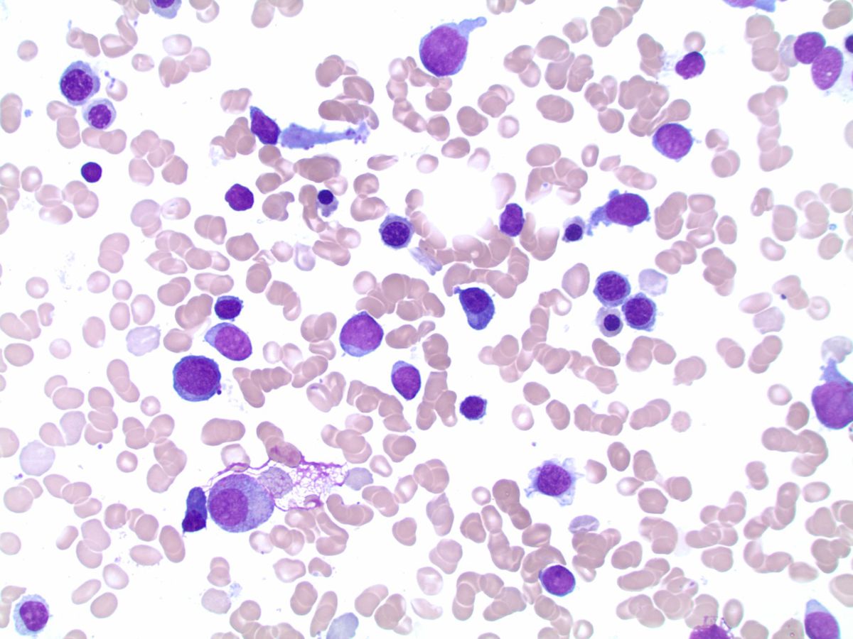 Smear with blasts 500x